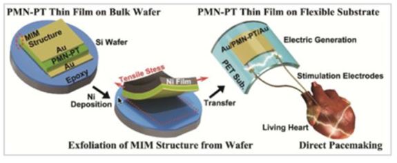 Body Image 4-Recent Advances in Implantable-BioMEMS-Electronics