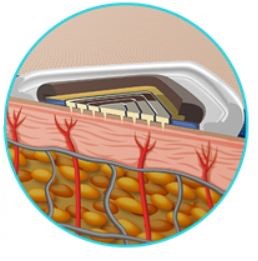 Body Image 6-Recent Advances in Implantable-BioMEMS-Electronics